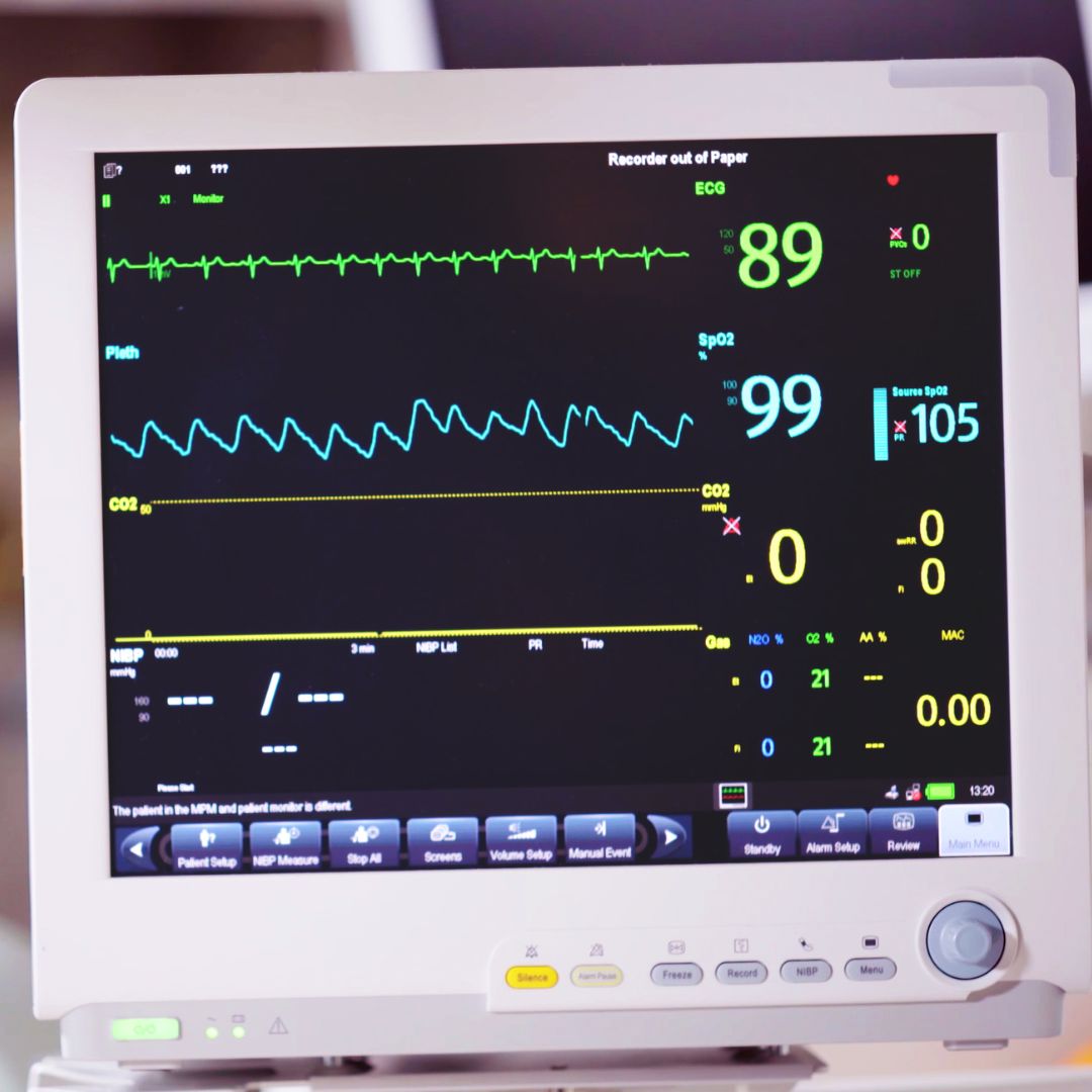 ECG monitor